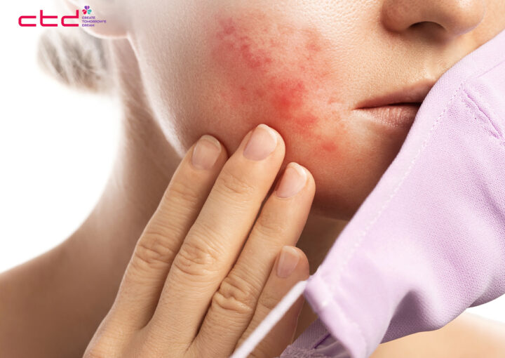 why am i still breaking out with a good skincare routine