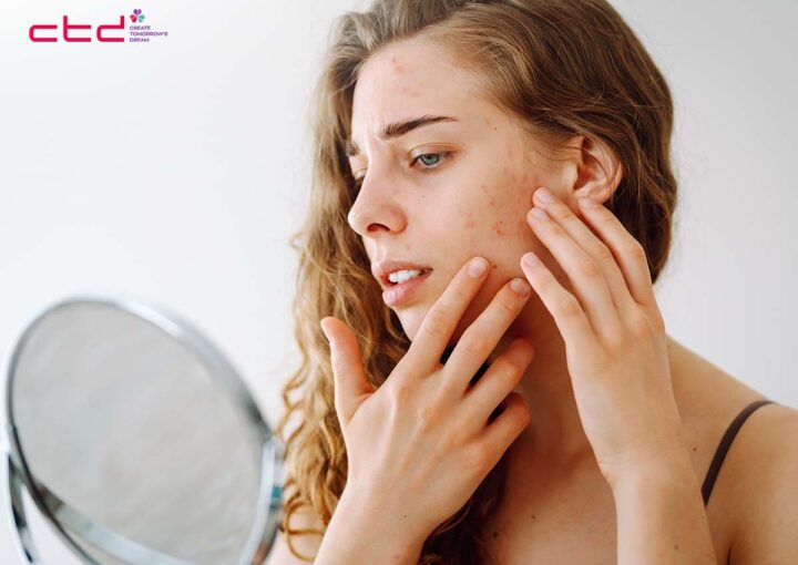 why does my skin burn after skincare