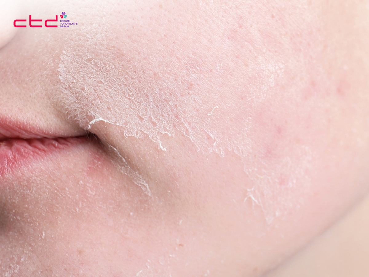 Skincare Tips for Dry Skin